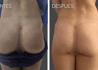 Extracción de biopolímeros